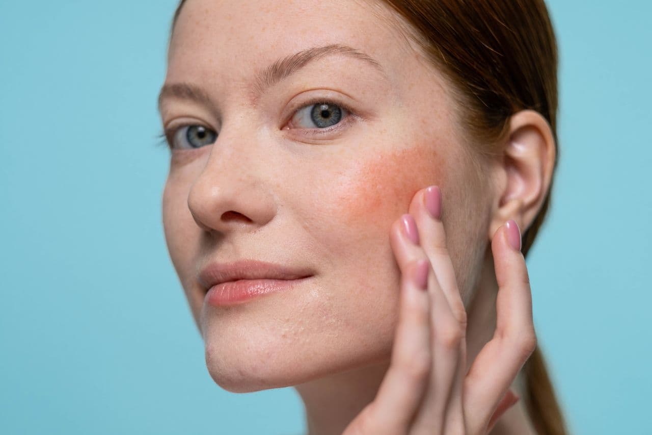 Wysypka po powrocie z wakacji – kiedy konieczna jest konsultacja dermatologiczna